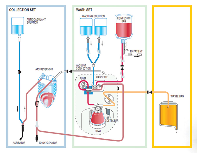 Diagrama 1